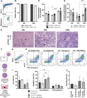 Tumor-neutrophil crosstalk promotes in vitro and in vivo glioblastoma progression